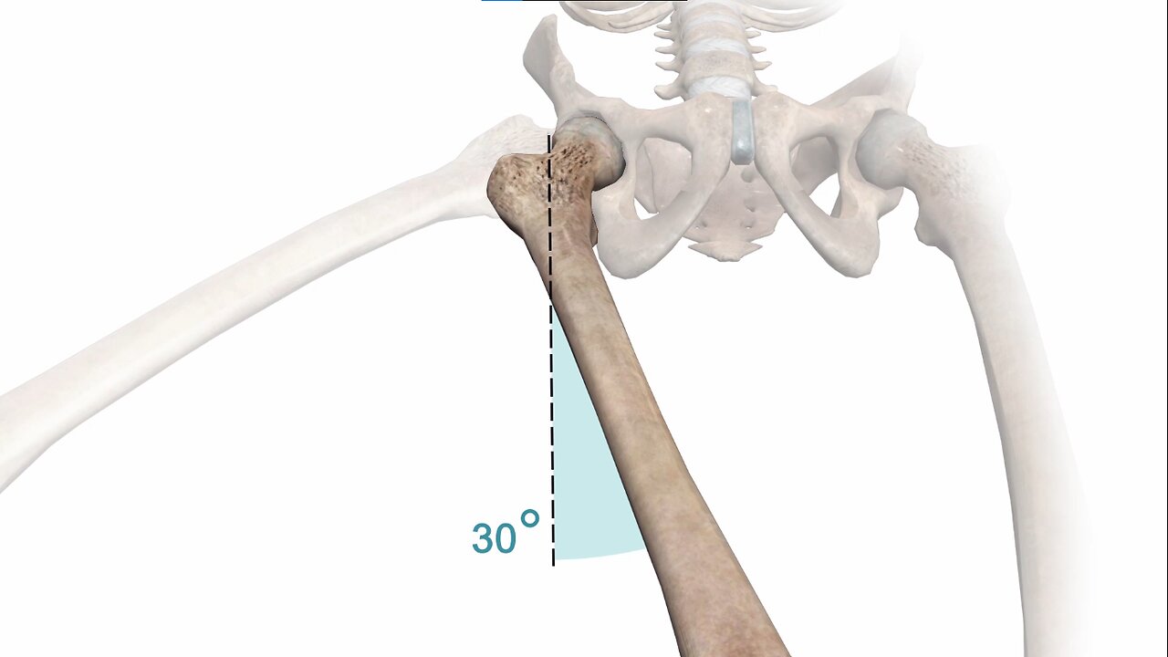 Animated human body anatomy of hip labral tear part 2 hip