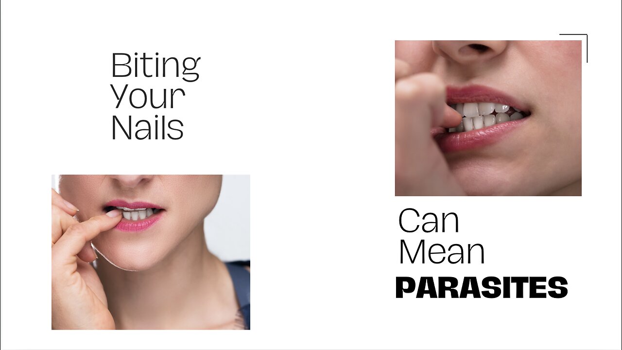 Biting Fingernails Risks Parasites????