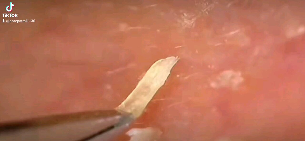 So Satisfying!