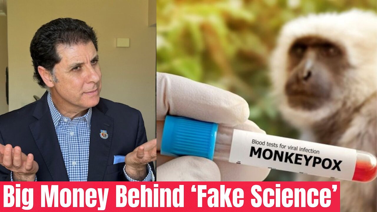 Big Money behind Worldwide Monkeypox Pandemic Scare!