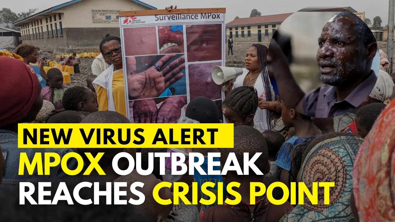 New Virus Alert | Mpox outbreak 2024 | Mpox disease | Mpox Global Health Emergency