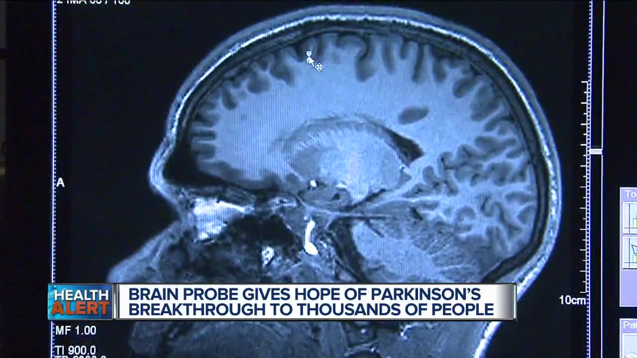 Hope for Parkinson’s sufferers as breakthrough trial shows how damage to brain cells could be REVERSED with a life-changing drug