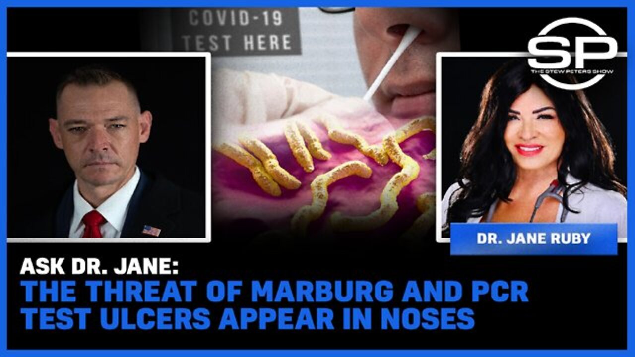 STEW PETERS SHOW 5/18/22 - Ask Dr. Jane: The Threat Of Marburg And PCR Test Ulcers Appear In Noses