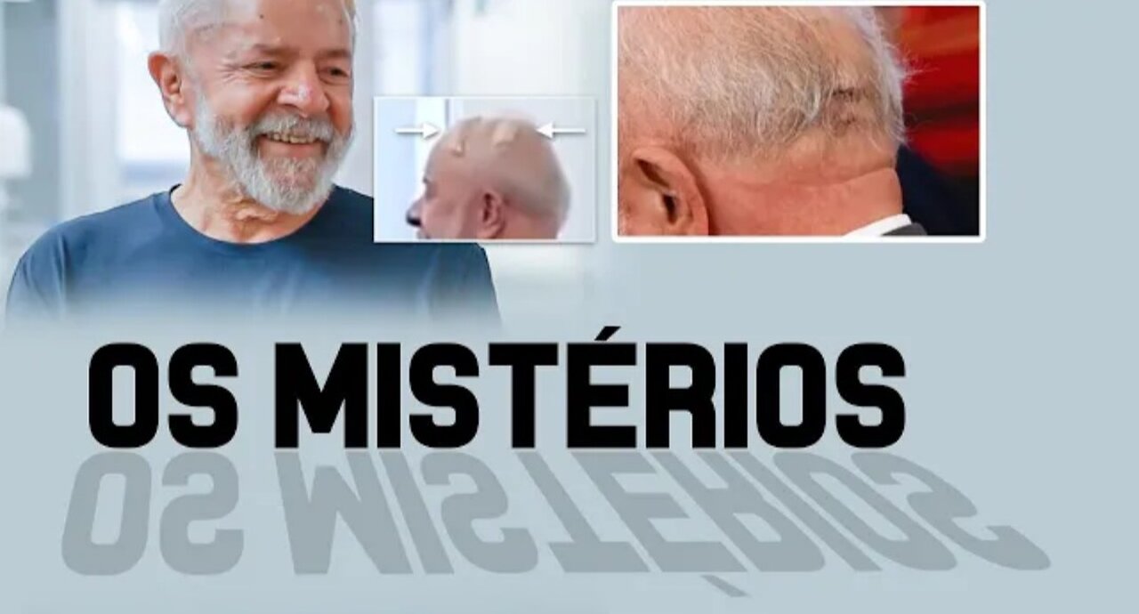 What's going on with Lula? Mystery about his health