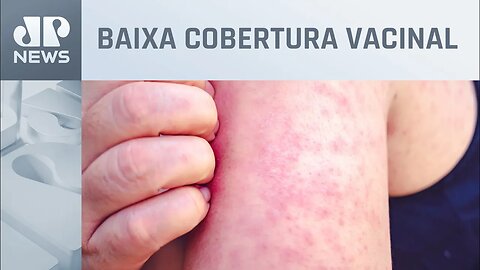 OMS alerta: Mortes por sarampo aumentam 43% em 2022