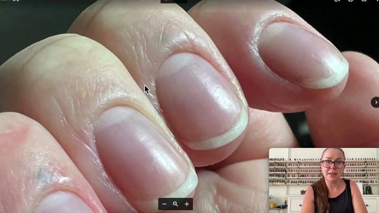 Swollen and puffy "cuticles" advice [Anna's Nail Advice]