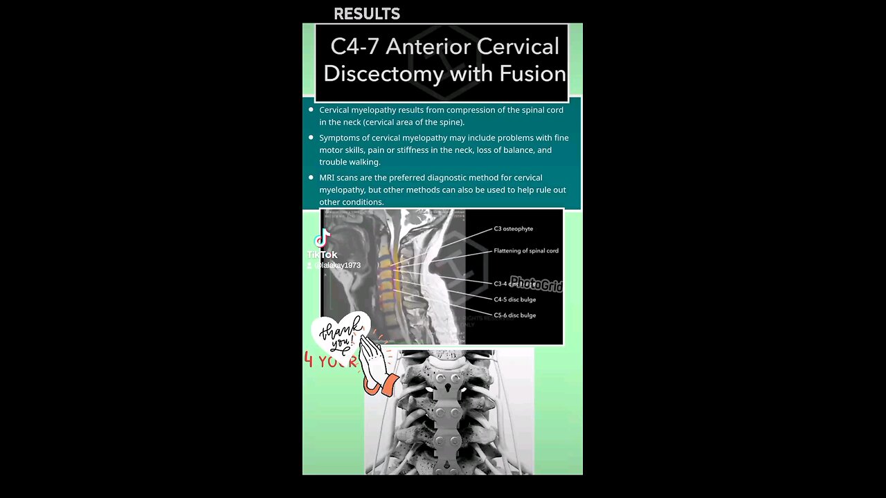 Results MRI & Drs advice