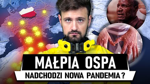 MAŁPIA 0SPA - nowa choroba zagraża POLSCE?