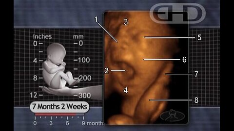 DEMOCRATS DON'T WANT TO TALK ABOUT LATE TERM ABORTIONS — AND NEITHER DO GOP!