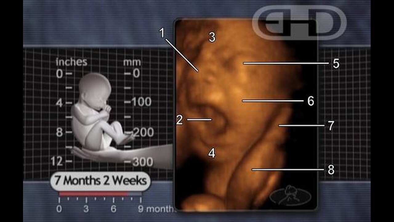 DEMOCRATS DON'T WANT TO TALK ABOUT LATE TERM ABORTIONS — AND NEITHER DO GOP!