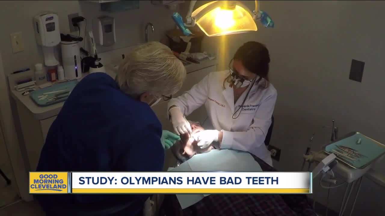 Tooth decay more common among Olympians