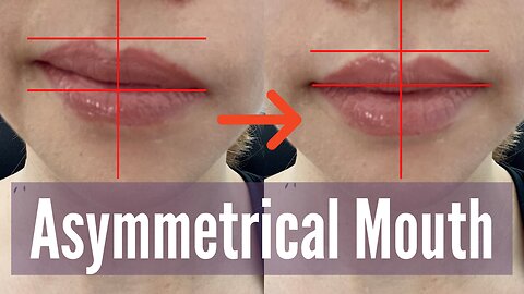 Fix asymmetrical mouth and lips | Koko Face Yoga