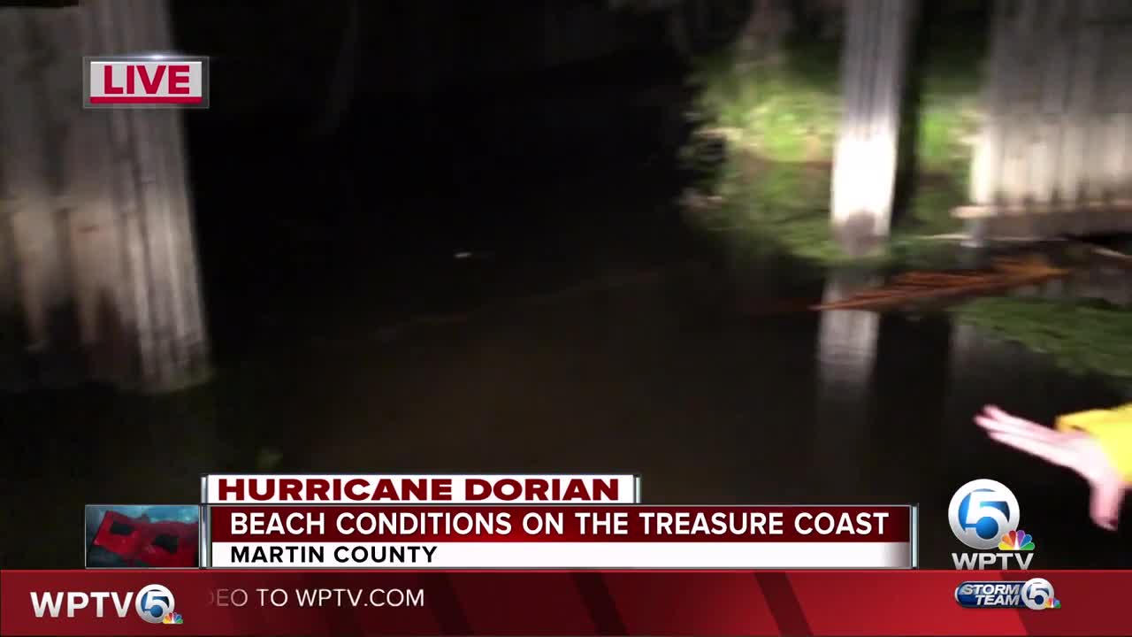 Beach conditions on the Treasure Coast