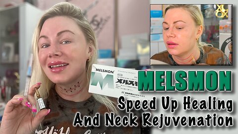 Melsmon: Speed Up Healing During Neck Rejuvination! AceCosm.com, code Jessica10 Saves