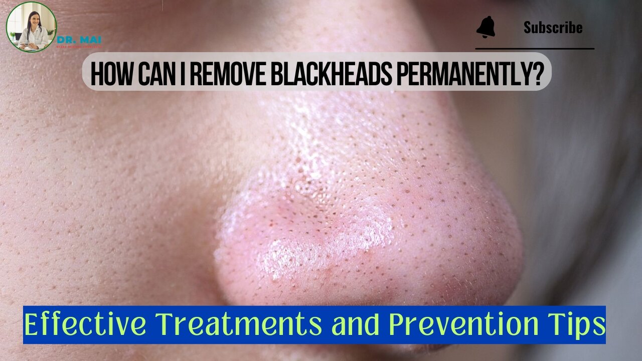 How Can I Remove Blackheads Permanently? | DR. MAI