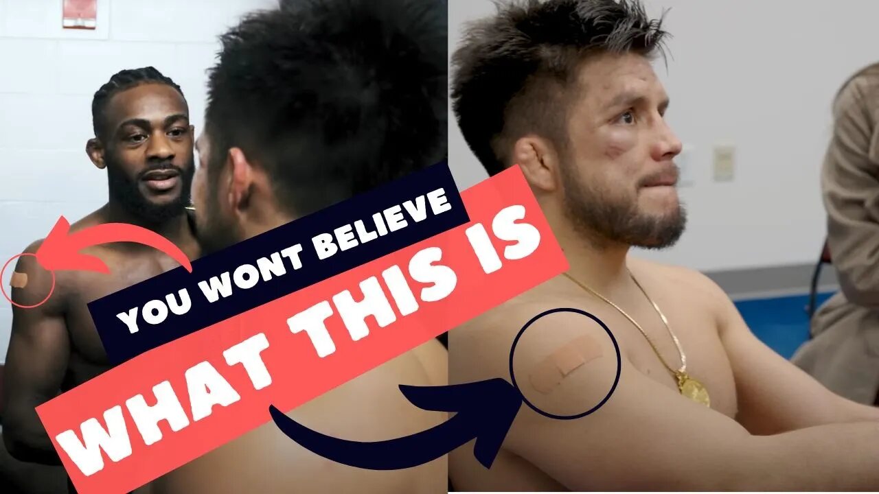 Explained: Why Do UFC Fighters Have Plasters On Their Arms After Fights?