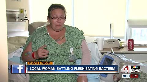 Topeka mom battling 'flesh-eating bacteria'