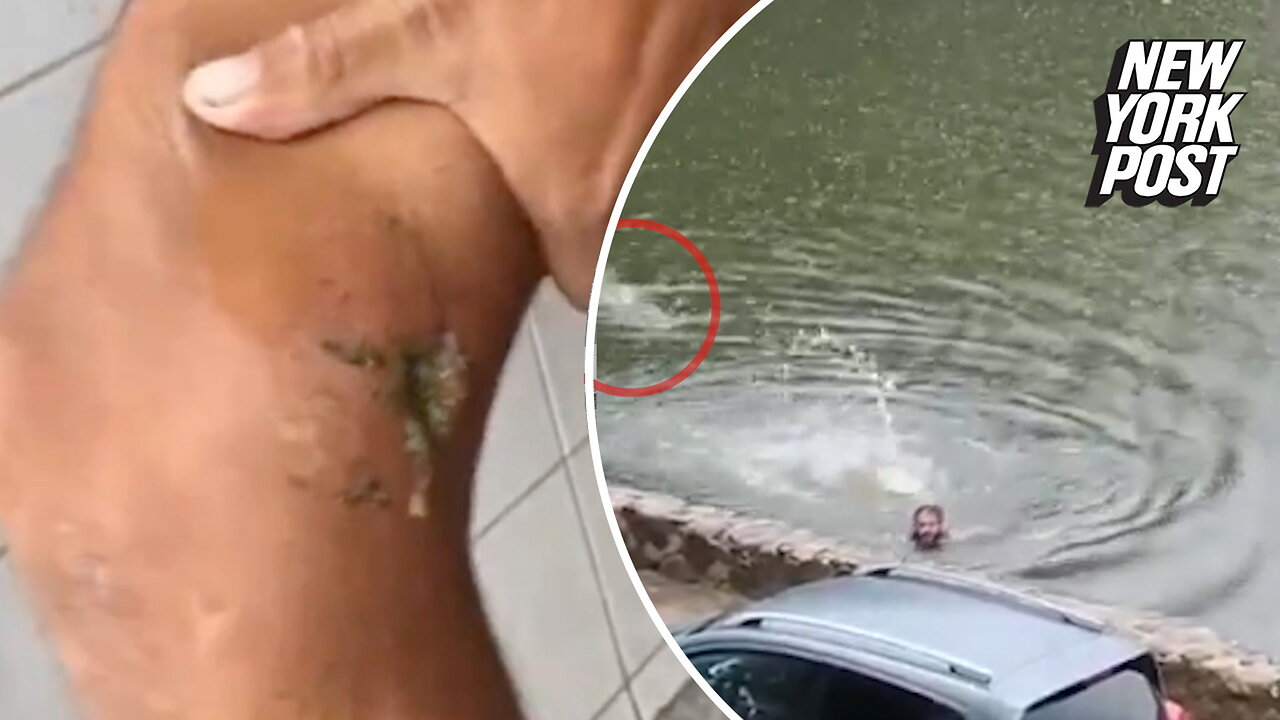 Man vs. croc! Swimmer breaks free after crocodile chomps his leg