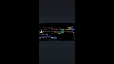 $EURUSD | 1H Trade Setup Update 🟢 Long Position: - Entry: Long at 1.103