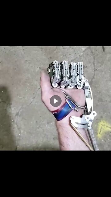 Engineer Ian Davis designed a mechanical prosthesis that operates without batteries or electricity.