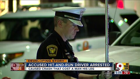 Accused hit-and-run driver arrested after crash severed man's leg