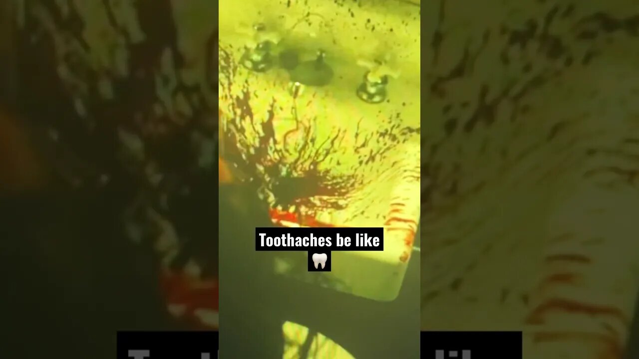 Toothaches be like 🦷🩸 #pain #clips