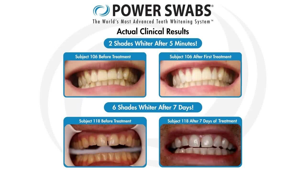 See how you can get a whiter, brighter smile in just minutes with Power Swabs!