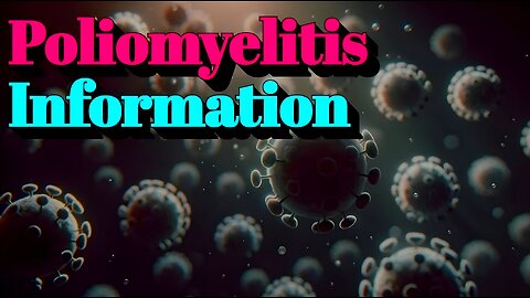 Poliomyelitis - Infection Navigator