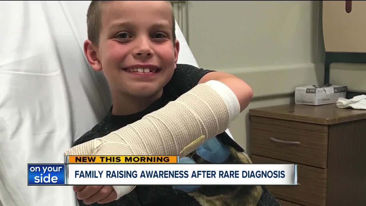 Ravenna family raising awareness after a rare diagnosis