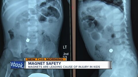Mother warns other parents of the dangers of magnets
