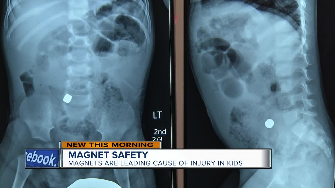Mother warns other parents of the dangers of magnets