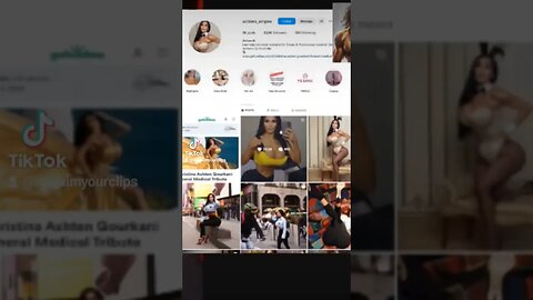 Women Nowadays are Willing to Spend a lot of Money For Surgery Even if it Will Harm Them #reclaim