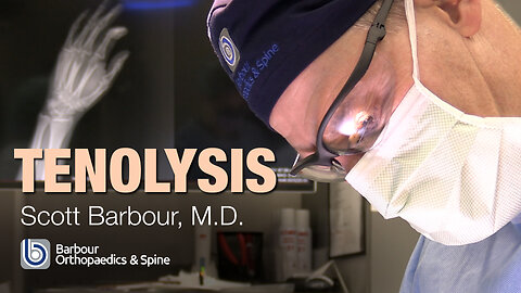 TENOLYSIS