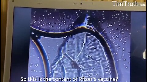 Pfizer "vaccine" under a microscope