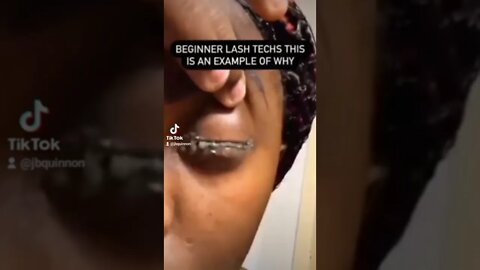 Bad hygiene