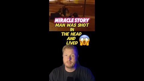 This guy was shot in the head, then this happened😱😳 #shorts #miracle