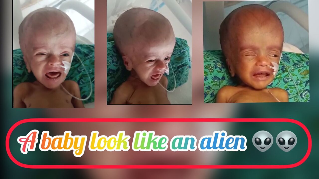 A baby look like an Alien.