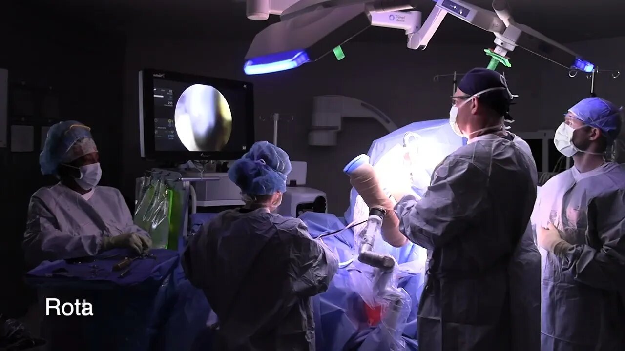 Rotator Cuff Repair - Scott A. Barbour, M.D.
