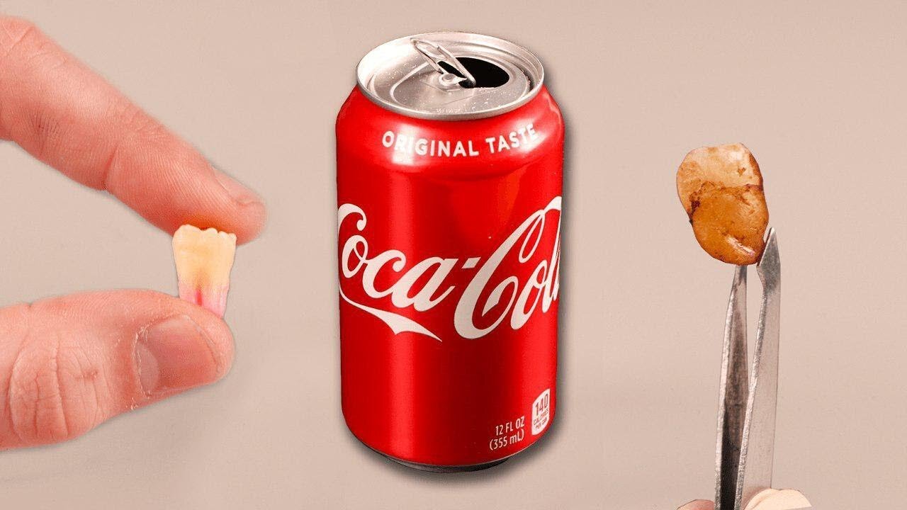 I Put a Tooth In Coca Cola For 24 Hours