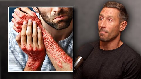 The True Cause of Eczema & How to Heal