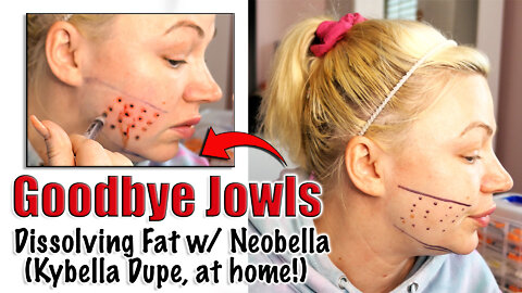 Goodbye Jowls : Dissolving Fat Neobella from www.glamderma.com | Code Jessica10 Saves you Money!