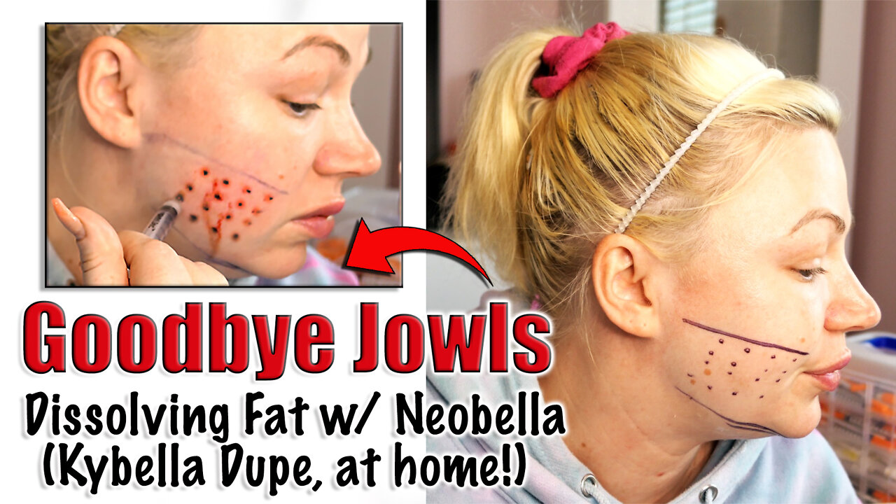 Goodbye Jowls : Dissolving Fat Neobella from www.glamderma.com | Code Jessica10 Saves you Money!