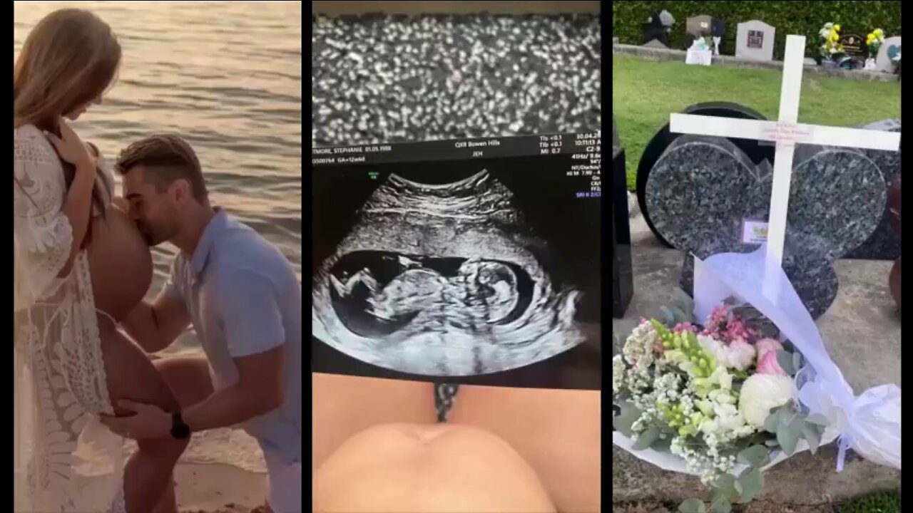 SAFE & EFFECTIVE Fetus dies of a brain hemorrhage, clot days after of mother getting COVID jab