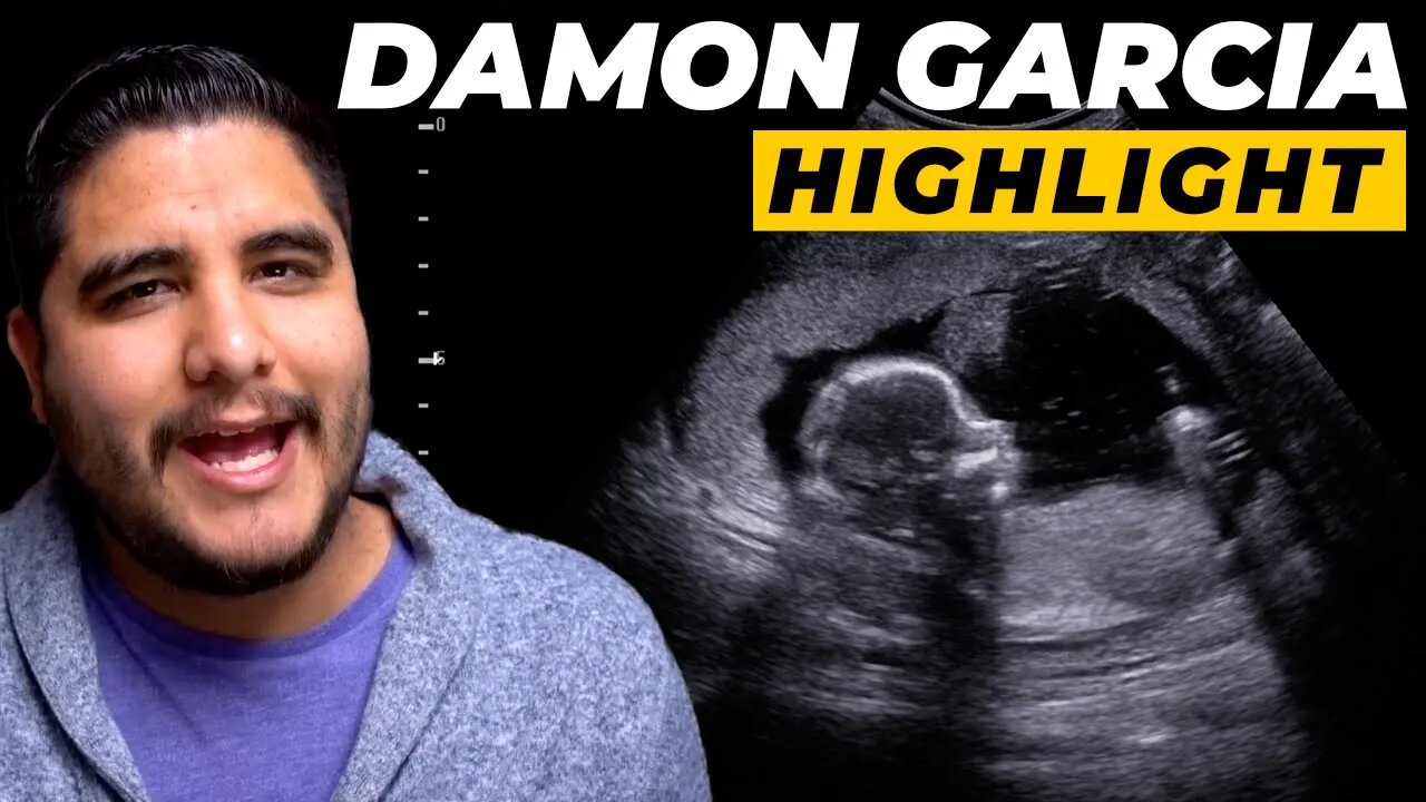 Damon Garcia on Why He Accepts the LGBTQ+ Lifestyle & Ab*rtion as "Christian" (Highlight)