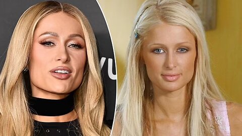 Paris Hilton Claims No Botox or Surgery