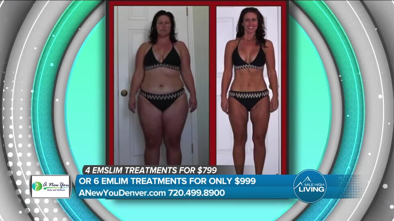 Discount On Laser Slimming! // A New You