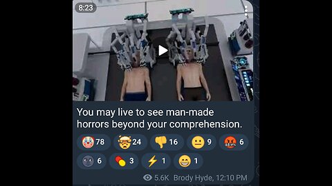 Documentary: Head Transplant Technology