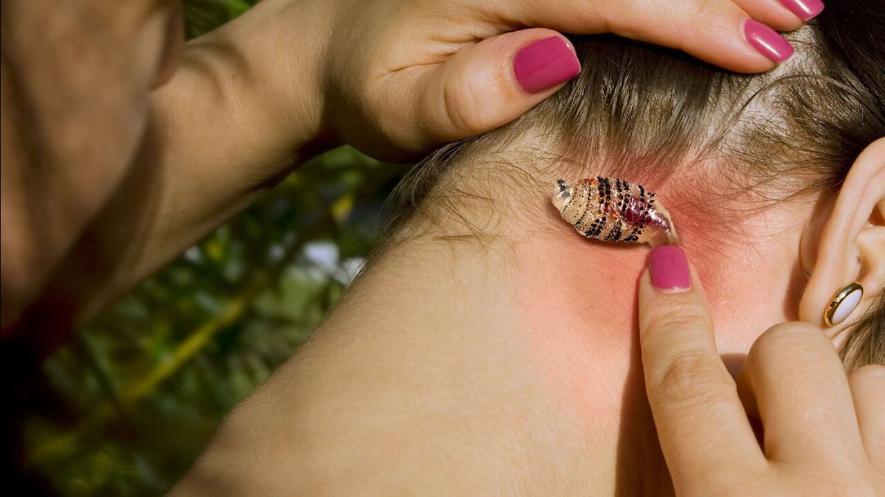 Botflies Are the Grossest Parasites on Earth