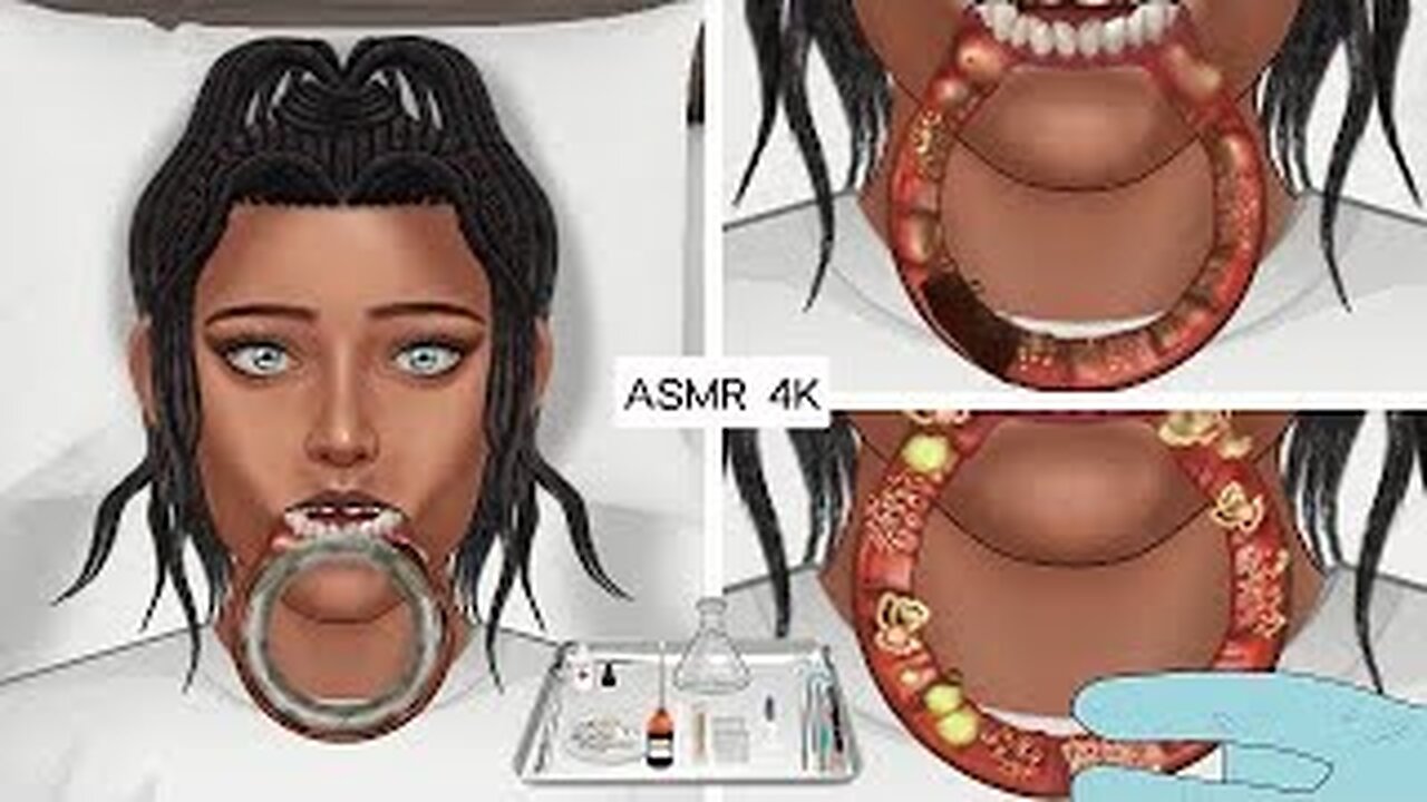 ASMR Treatment and removal of swelling caused by wearing large lip piercings