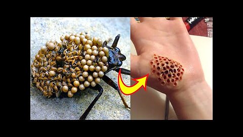 Top 10 Most Dangerous Bugs in the World